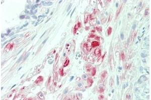 Immunohistochemistry (IHC) image for anti-Protein Tyrosine Phosphatase-Like (Proline Instead of Catalytic Arginine), Member A (PTPLA) (AA 37-66) antibody (ABIN1927972)