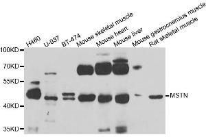 Western blot analysis of extracts of various cell lines, using MSTN antibody. (MSTN Antikörper)