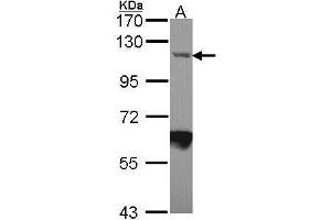 WB Image Sample (30 ug of whole cell lysate) A: JurKat 7. (IPO7 Antikörper  (C-Term))