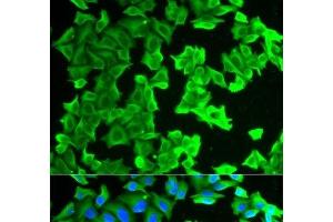 Immunofluorescence analysis of HeLa cells using RPLP0 Polyclonal Antibody (RPLP0 Antikörper)