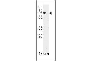 Western blot analysis of anti-TIEG Antibody (N-term) (ABIN392159 and ABIN2841880) pre-incubated with and without blocking peptide in CEM cell line lysate. (KLF10/TIEG1 Antikörper  (N-Term))