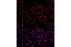 Immunofluorescence (IF) image for anti-X-Ray Repair Complementing Defective Repair in Chinese Hamster Cells 4 (XRCC4) (AA 1-336) antibody (ABIN3022382)