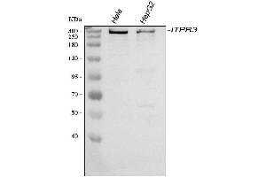 Western blot analysis of ITPR3 using anti-ITPR3 antibody (ABIN3043863).