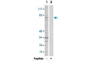 Western blot analysis of extracts from HepG2 cells, using DDX51 polyclonal antibody . (DDX51 Antikörper  (C-Term))