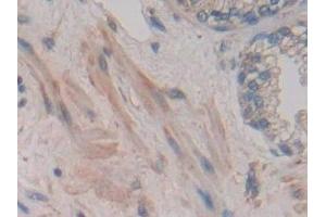 Immunohistochemistry (IHC) image for anti-Jagged 2 (JAG2) (AA 714-981) antibody (ABIN7439534)