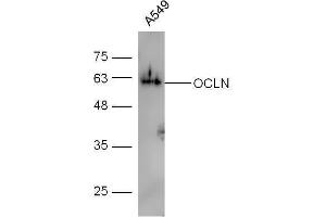 Human A549 lysates probed with Rabbit Anti-Occludin Polyclonal Antibody, Unconjugated  at 1:5000 for 90 min at 37˚C. (Occludin Antikörper  (AA 431-522))