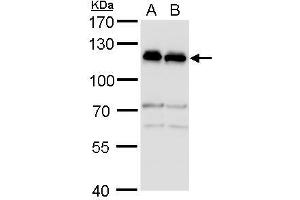 WB Image alpha Adducin antibody detects alpha Adducin protein by western blot analysis. (alpha Adducin Antikörper)