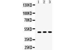 Western Blotting (WB) image for anti-Sequestosome 1 (SQSTM1) (AA 69-96), (N-Term) antibody (ABIN3043937)