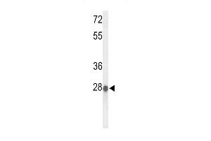 Western blot analysis of ABHDB Antibody (Center) (ABIN653369 and ABIN2842841) in MCF-7 cell line lysates (35 μg/lane). (ABHD11 Antikörper  (AA 176-205))