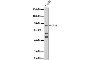Western blot analysis of extracts of HepG2 cells, using CRNN antibody (ABIN6127877, ABIN6139056, ABIN6139057 and ABIN6224784) at 1:1000 dilution. (CRNN Antikörper  (AA 396-495))