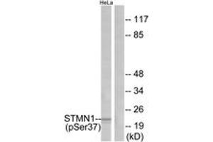 Western blot analysis of extracts from HeLa cells treated with nocodazole, using Stathmin 1 (Phospho-Ser37) Antibody. (Stathmin 1 Antikörper  (pSer38))