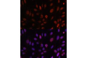 Immunofluorescence analysis of U-2 OS cells using HOXB1 antibody (ABIN6128032, ABIN6141942, ABIN6141943 and ABIN6222309) at dilution of 1:100. (HOXB1 Antikörper  (AA 35-180))