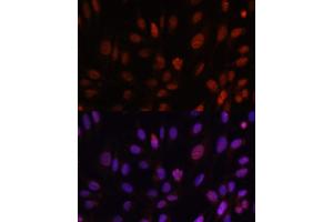 Immunofluorescence analysis of U-2 OS cells using HOXB1 antibody (ABIN6128032, ABIN6141942, ABIN6141943 and ABIN6222309) at dilution of 1:100. (HOXB1 Antikörper  (AA 35-180))