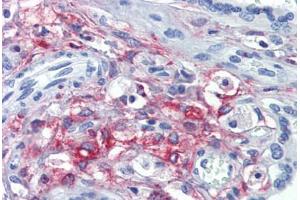Placenta, Human: Formalin-Fixed, Paraffin-Embedded (FFPE) (SLC46A1 Antikörper  (AA 57-70))