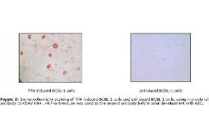 Image no. 1 for anti-KSHV K8 alpha antibody (ABIN478368) (KSHV K8 alpha Antikörper)
