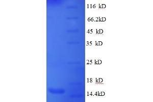 SDS-PAGE (SDS) image for Brain-Derived Neurotrophic Factor (BDNF) (AA 136-243), (partial) protein (His tag) (ABIN5713036)