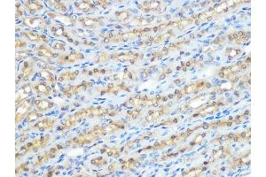 Immunohistochemistry (IHC) image for anti-Protein Phosphatase 1, Catalytic Subunit, beta Isoform (PPP1CB) antibody (ABIN1679819)