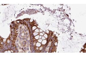 ABIN6272885 at 1/100 staining Mouse colon tissue by IHC-P. (Pallidin Antikörper  (C-Term))