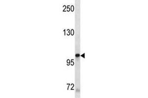 KIT antibody western blot analysis in A549 lysate (KIT Antikörper)