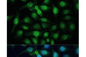Immunofluorescence analysis of HeLa cells using ZWINT Polyclonal Antibody at dilution of 1:100 (40x lens). (ZWINT Antikörper)