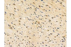 ABIN7093251 and ABIN7097268 at 1/100 staining Rat heart tissue by IHC-P.