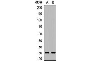 Western blot analysis of ATF5 expression in Jurkat (A), NIH3T3 (B) whole cell lysates. (ATF5 Antikörper  (C-Term))