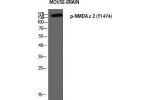 Western Blot (WB) analysis of Mouse Brain using p-NMDAepsilon2 (Y1474) antibody. (NMDA epsilon 2 (pTyr1474) Antikörper)