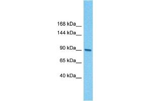 Western Blotting (WB) image for anti-E2F Transcription Factor 7 (E2F7) (N-Term) antibody (ABIN2780153)
