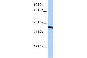 RPLP0 antibody used at 0. (RPLP0 Antikörper  (N-Term))