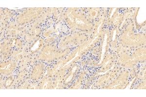 Detection of CD40L in Human Kidney Tissue using Monoclonal Antibody to Cluster Of Differentiation 40 Ligand (CD40L) (CD40 Ligand Antikörper  (AA 180-261))