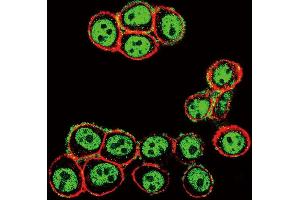 Confocal immunofluorescent analysis of Phospho-SD3- Antibody (ABIN389656 and ABIN2850451) with Hela cell followed by Alexa Fluor 488-conjugated goat anti-rabbit lgG (green). (SMAD3 Antikörper  (pSer208))