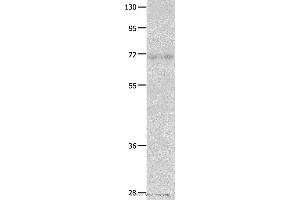 Western blot analysis of Human fetal lung tissue  , using IGF2BP1 Polyclonal Antibody at dilution of 1:500 (IGF2BP1 Antikörper)