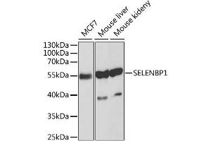 Western blot analysis of extracts of various cell lines, using SELENBP1 antibody.