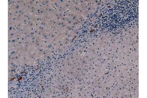 Detection of CK19 in Human Liver Tissue using Monoclonal Antibody to Cytokeratin 19 (CK19)