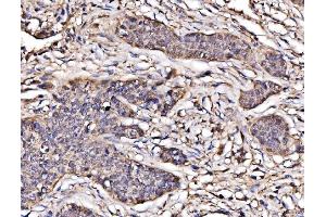 IHC analysis of PAK2 using anti-PAK2 antibody (ABIN7599219). (PAK2 Antikörper  (AA 1-288))