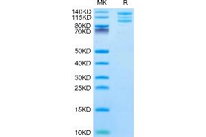 Rhesus macaque ITGAV&ITGB6 on Tris-Bis PAGE under reduced condition. (ITGAV/ITGB6 Protein (AA 31-993) (His tag))