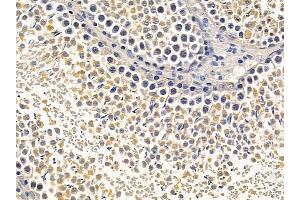 ABIN6257099 and ABIN6275623 at 1/100 staining rat testis tissue by IHC-P. (CCT5 Antikörper  (Internal Region))