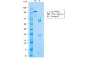 SDS-PAGE Analysis Purified p63 Rabbit Monoclonal Antibody (TP63/1423R). (p63 Antikörper)