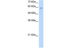 WB Suggested Anti-ARIH2 Antibody Titration:  2. (ARIH2 Antikörper  (N-Term))