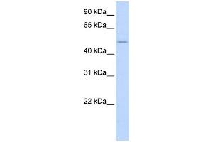 WB Suggested Anti-WNT2B Antibody Titration:  0. (WNT2B Antikörper  (N-Term))