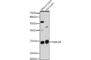 Western blot analysis of extracts of various cell lines, using RB antibody (ABIN7269795) at 1:1000 dilution. (RAB11B Antikörper  (AA 130-215))