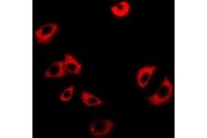 Immunofluorescent analysis of NUP62 staining in Jurkat cells.