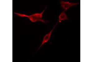ABIN6274419 staining NIH-3T3 cells by IF/ICC. (TRIM59 Antikörper  (Internal Region))