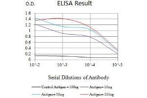 Black line: Control Antigen (100 ng),Purple line: Antigen (10 ng), Blue line: Antigen (50 ng), Red line:Antigen (100 ng)