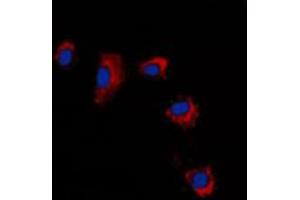 Immunofluorescent analysis of Claudin 2 staining in A431 cells. (Claudin 2 Antikörper  (C-Term))