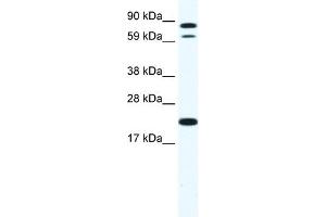 WB Suggested Anti-ZFP287 Antibody Titration:  1. (ZNF287 Antikörper  (N-Term))
