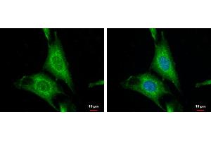 ICC/IF Image WNT10A antibody [N1C1-2] detects WNT10A protein at cytoplasm by immunofluorescent analysis. (WNT10A Antikörper  (Center))