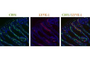 Immunohistochemistry detection of endogenous LYVE-1 in cryo sections of mouse colon carcinoma using anti-LYVE-1, pAb  (red) and anti-mouse CD31 pAb (green).