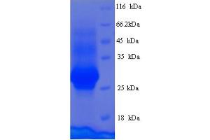 SDS-PAGE (SDS) image for Cementum Protein 1 (CEMP1) (AA 1-247), (full length) protein (His tag) (ABIN5714402)