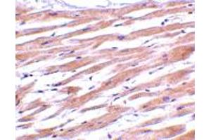 Immunohistochemistry of UNG in human heart tissue with UNG polyclonal antibody  at 2 ug/mL . (UNG Antikörper  (C-Term))